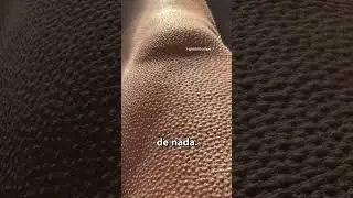 If you see this on your SKIN, run! 😨