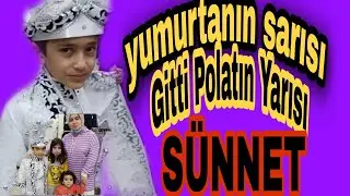 TİKTOK FENOMENİ POLAT SÜNNET OLUYOR fenomenailesi