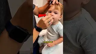 Что-то Шевелилось У Него В Носу… Но Оказалось Вот Что! 🤯