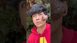 IT'S GOING TO GROW ON YOUR FACE